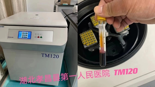 Latest company news about Centrigue de PRP